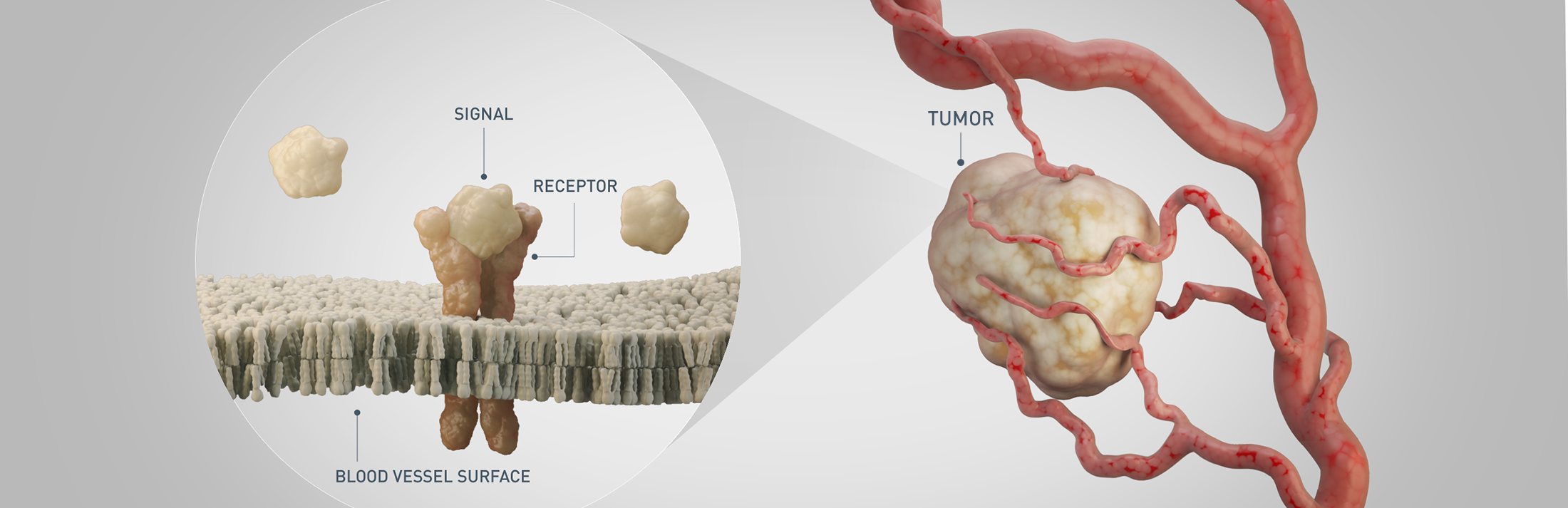 tumor without treatment